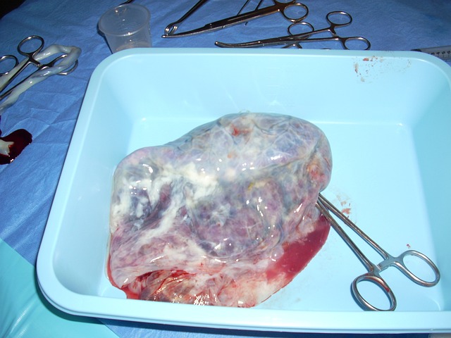 gioielli cordone ombelicale
